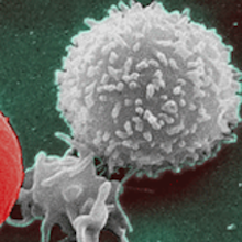 NCI.Red_White_Blood_cells