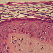 microscope photo of a section of skin tissue