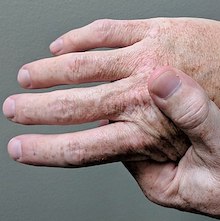 photo of person holding hand in pain