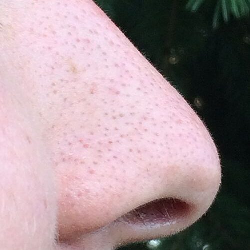 DiCorato: Our Lines of Defense: A Look into Nasal Immunity